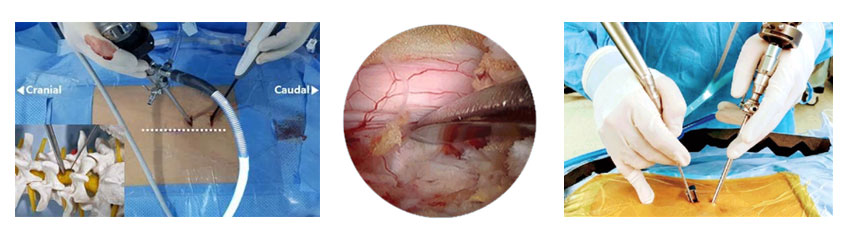 Best Spine Surgeon in Vashi